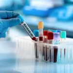 blood test